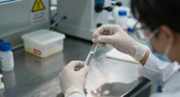 Cases of ‘explosive diarrhea' infections spread in U.S., with major Midwest outbreak