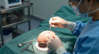 A Controversial Alzheimer's Surgery Is Said To Reverse Symptoms