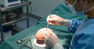 A Controversial Alzheimer's Surgery Is Said To Reverse Symptoms